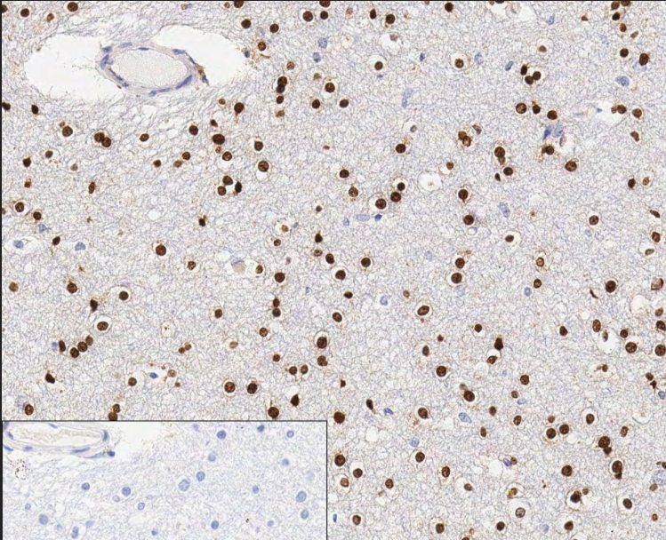 重组Anti-Olig2抗体[EPR2673] (ab109186)