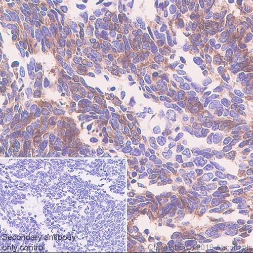 重组Anti-DLL3抗体[EPR22592-18] (ab229902)