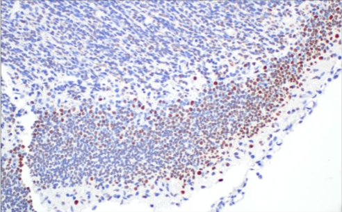 FOXG1（E2W8P）兔子mab＃29642