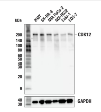 CDK12（E8G6X）RABBIT MAB＃45791