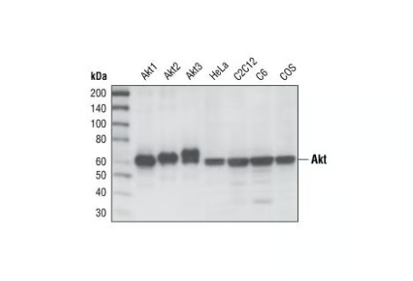 AKT（PAN）（11E7）Rabbit Mab＃4685