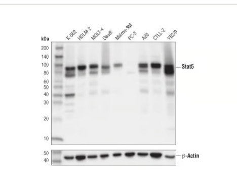 Stat5（D2O6Y）兔子mab＃94205