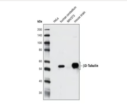 β3微管蛋白（D71G9）XP兔子mab＃5568
