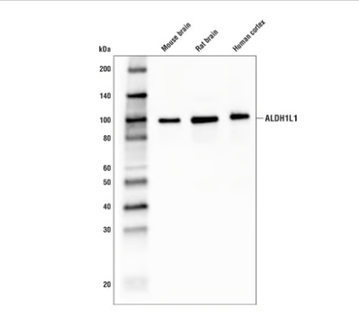aldh1l1（e7d7g）兔子mab＃34391